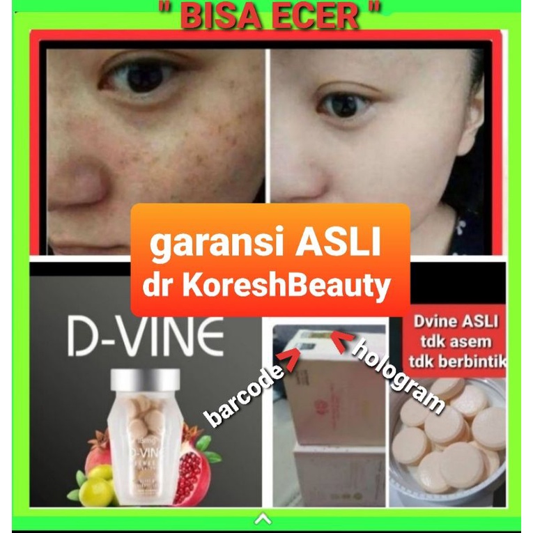 Press alt to open this menu. D Vine Dvine Collagen Original Pemutih Kulit Hati2 Banyak Yg Jual Murah Tp Palsu Shopee Indonesia