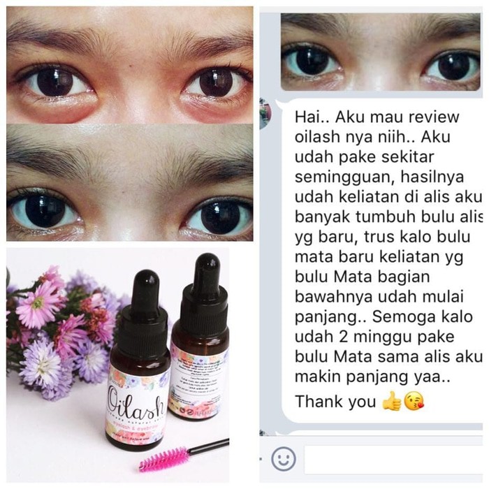 Oilash merupakan serum berbentuk minyak yang diformulasikan khusus untuk bulu . Oilash Penebal Dan Penumbuh Bulumata Alis Shopee Indonesia
