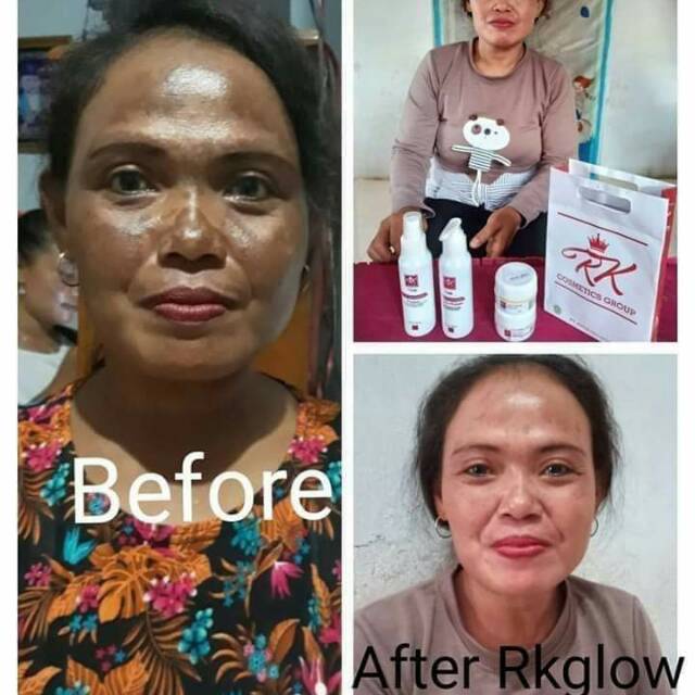 Rk glow acne mohon saat order tulis pesan nya premium atau acne , harga buat 1 . Rk Glow Premium Shopee Indonesia