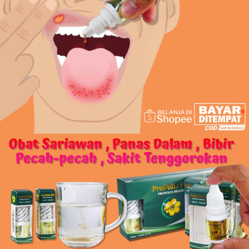 Sariawan dapat menyerang lidah, rongga mulut, tenggorokan, gusi, dan amandel. Obat Sariawan Panas Dalam Bibir Pecah Pecah Tenggorokan Sakit Propolis Sm Bisa Cod Shopee Indonesia