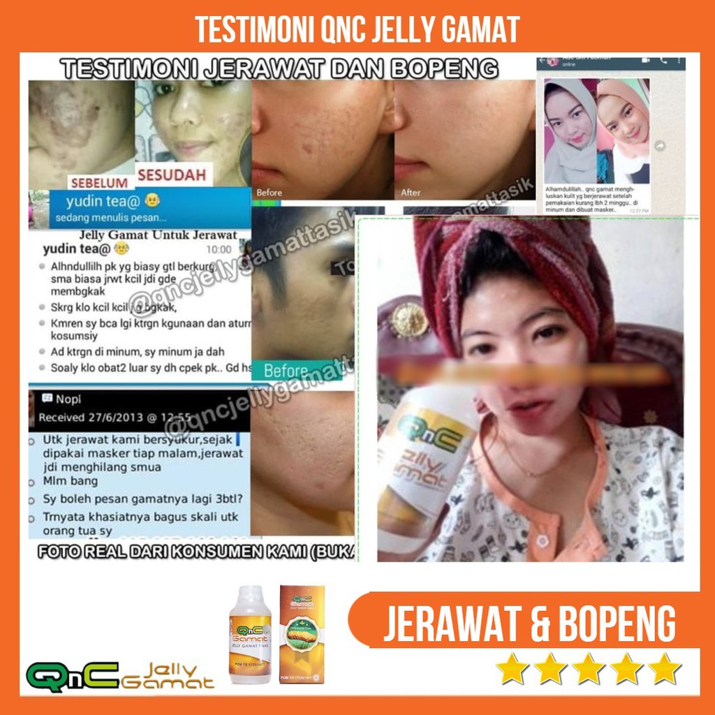Bintik putih adalah benjolan berwarna putih kecil yang . Cod Obat Oles Penghilang Jerawat Jerawat Batu Jerawat Kecil Bekas Jerawat Bopeng Flek Hitam Shopee Indonesia