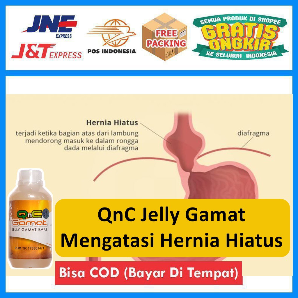 Beberapa jenis hernia, seperti hernia hiatus terjadi karena menonjolnya bagian . Bisa Cod Obat Herbal Mengatasi Hernia Hernia Hiatus Hernia Akut Shopee Indonesia