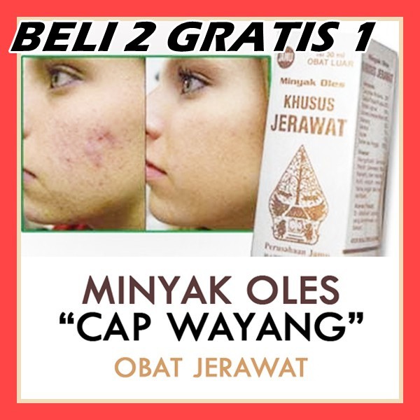 Antibiotik topikal yang paling umum digunakan untuk pengobatan jerawat adalah eritromisin, yang merupakan antibiotik makrolid, dan clindamycin, yang merupakan . Jual Ampuh Obat Jerawat Parah Wayang Jerawat Bpom Hilangkan Bopeng Di Muka Pria Minyak Bisul Bpom Indonesia Shopee Indonesia