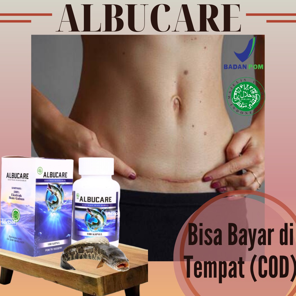 Beli produk caesar obat luka jahitan berkualitas dengan harga murah dari. Obat Luka Bekas Operasi Luka Jahitan Luka Operasi Caesar Luka Basah Luka Kering Albucare Shopee Indonesia