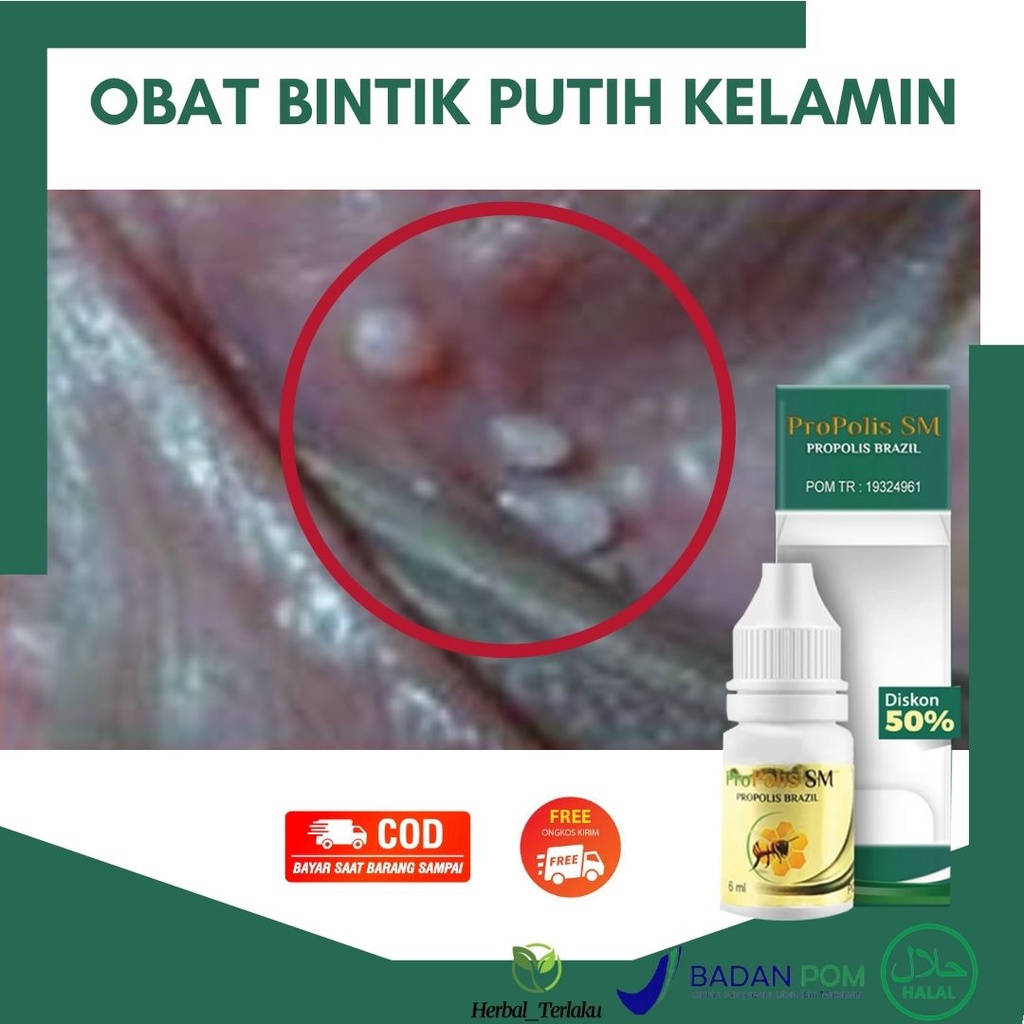Menurutnya, jerawat yang muncul di skrotum sama seperti jerawat di wajah atau punggung. Jual Obat Penis Bintik Bintik Putih Bintik Di Batang Kelamin Jerawat Kelamin Benjolan Kecil Bernanah Bintik Di Kepala Penis Gatal Bintik Merah Salep