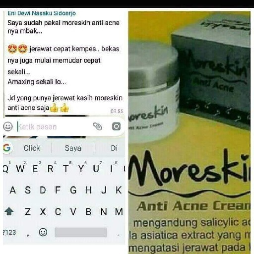 cara pemakaian safi natural white anti acne with tea tree oil. Moreskin Anti Acne Krim Penghilang Jerawat Pemutih Original Produk Nasa Shopee Indonesia