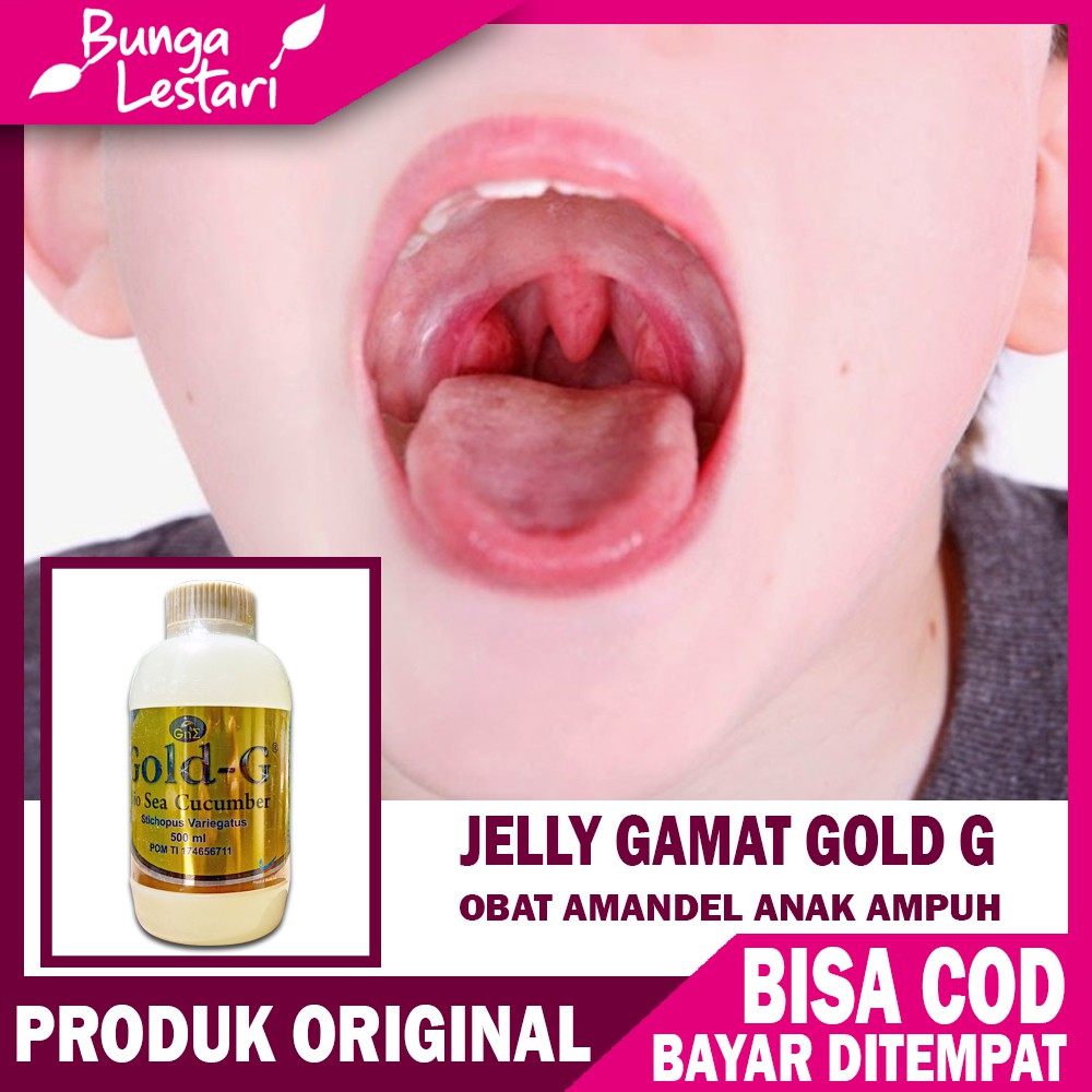 Berikut ini beberapa cara menyembuhkan amandel dengan buah. Obat Amandel Anak Radang Tenggorokan Atau Amandel Bengkak 100 Jelly Gamat Asli Shopee Indonesia