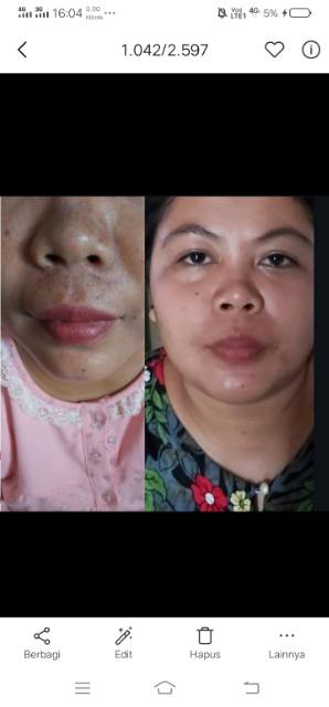 Cara penggunaan yang sangat praktis! Cream Pemutih Wajah Obat Flek Penghilang Bintik Hitam Tebal Dan Bekas Jerawat Glowing Shopee Indonesia