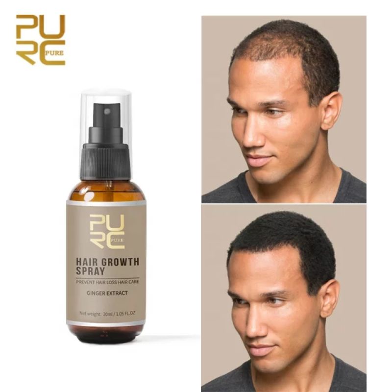 Harsh, prolonged, frequent chemical hair treatments such as bleaching, relaxing or permanently. Jual Purc Prevent Hair Loss Hair Growth Essence Oil 20ml Dan Spray 30ml Penumbuh Rambut Shopee Indonesia