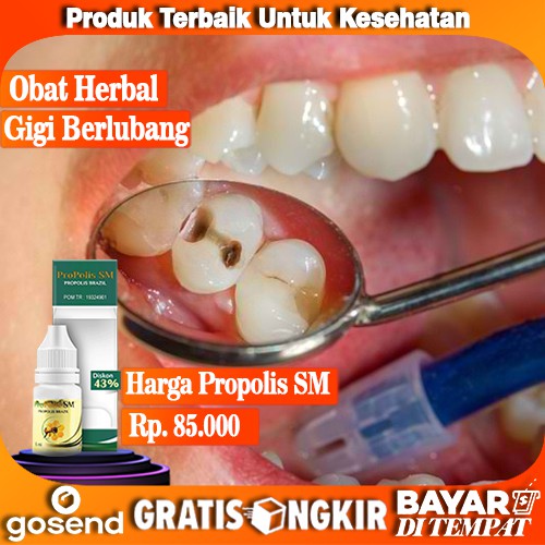 Pasta gigi yang mengandung propolis juga mampu mengatasi penyakit radang gusi atau gingivitis. Jual Obat Gigi Berlubang Obat Perontok Karang Gigi Obat Sakit Gigi Propolis Sm Original Indonesia Shopee Indonesia
