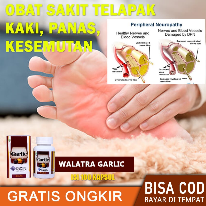 Jual Obat Kaki Kesemutan, Neuropati Periferal, Saraf Terjepit Di Kaki,  Telapak Kaki Terasa Panas, Telapak Kaki Sakit, Kaki Kaku Susah Berjalan,  Garlic Indonesia|Shopee Indonesia