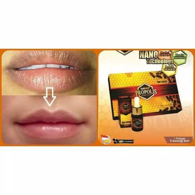Beli sunpro propolis (obat jerawat) terbaru di shopee. Jual Sunpro Propolis Atasi Penyakit Amandel Alergi Jerawat Parah Indonesia Shopee Indonesia