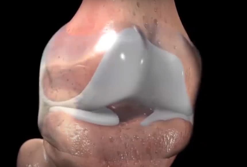 сколько кальция в скорлупе одного яйца. Смотреть фото сколько кальция в скорлупе одного яйца. Смотреть картинку сколько кальция в скорлупе одного яйца. Картинка про сколько кальция в скорлупе одного яйца. Фото сколько кальция в скорлупе одного яйца сколько кальция в скорлупе одного яйца. Смотреть фото сколько кальция в скорлупе одного яйца. Смотреть картинку сколько кальция в скорлупе одного яйца. Картинка про сколько кальция в скорлупе одного яйца. Фото сколько кальция в скорлупе одного яйца