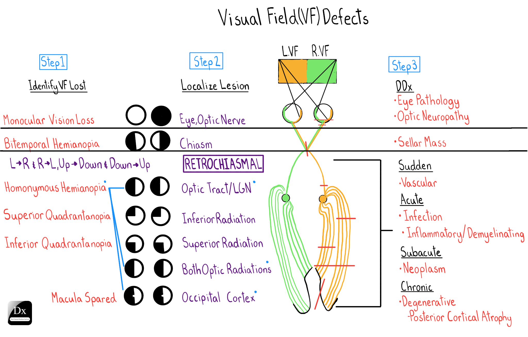 Dx schema visual field defects the clinical problem solvers