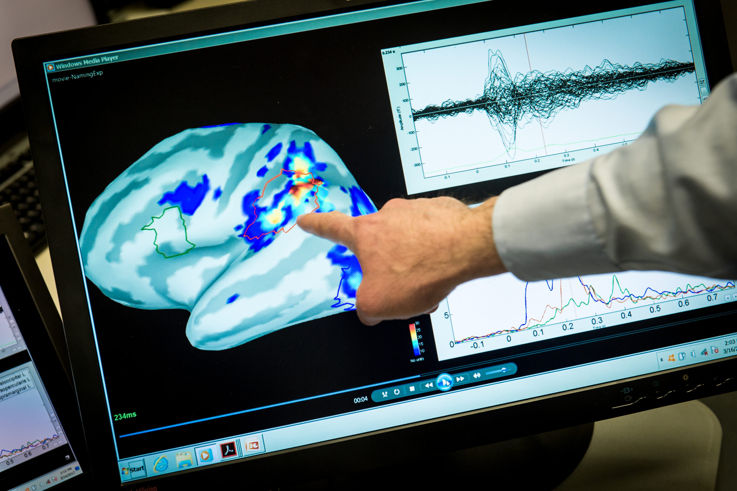 How a Veteran of an Elite IDF Unit is Changing Brain Injury Medicine - Vimarsana News