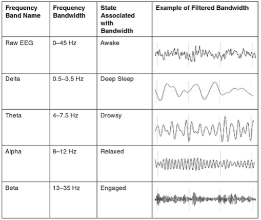 Eeg Wellentypen . Quelles sont les frÃ©quences des ondes dans l'EEG