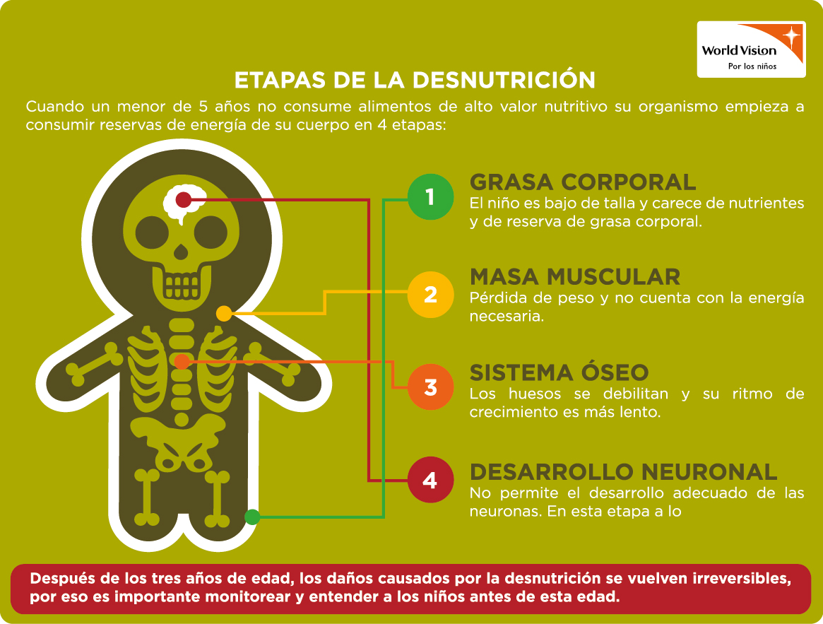 Que Es La Desnutrición Oms | Desnutrición: Causas, Factores de Riesgo