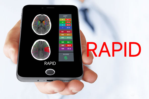 Get free demos and compare to similar programs. New Irapid Technology Benefits Stroke Patients