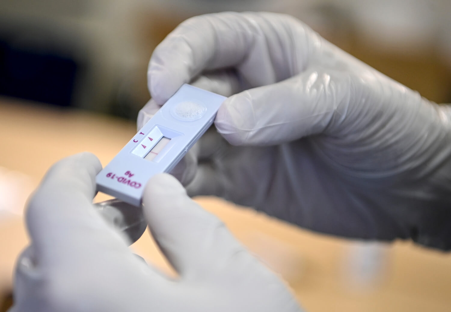 photo Sars Cov 2 Rapid Antigen Test Positiv 2