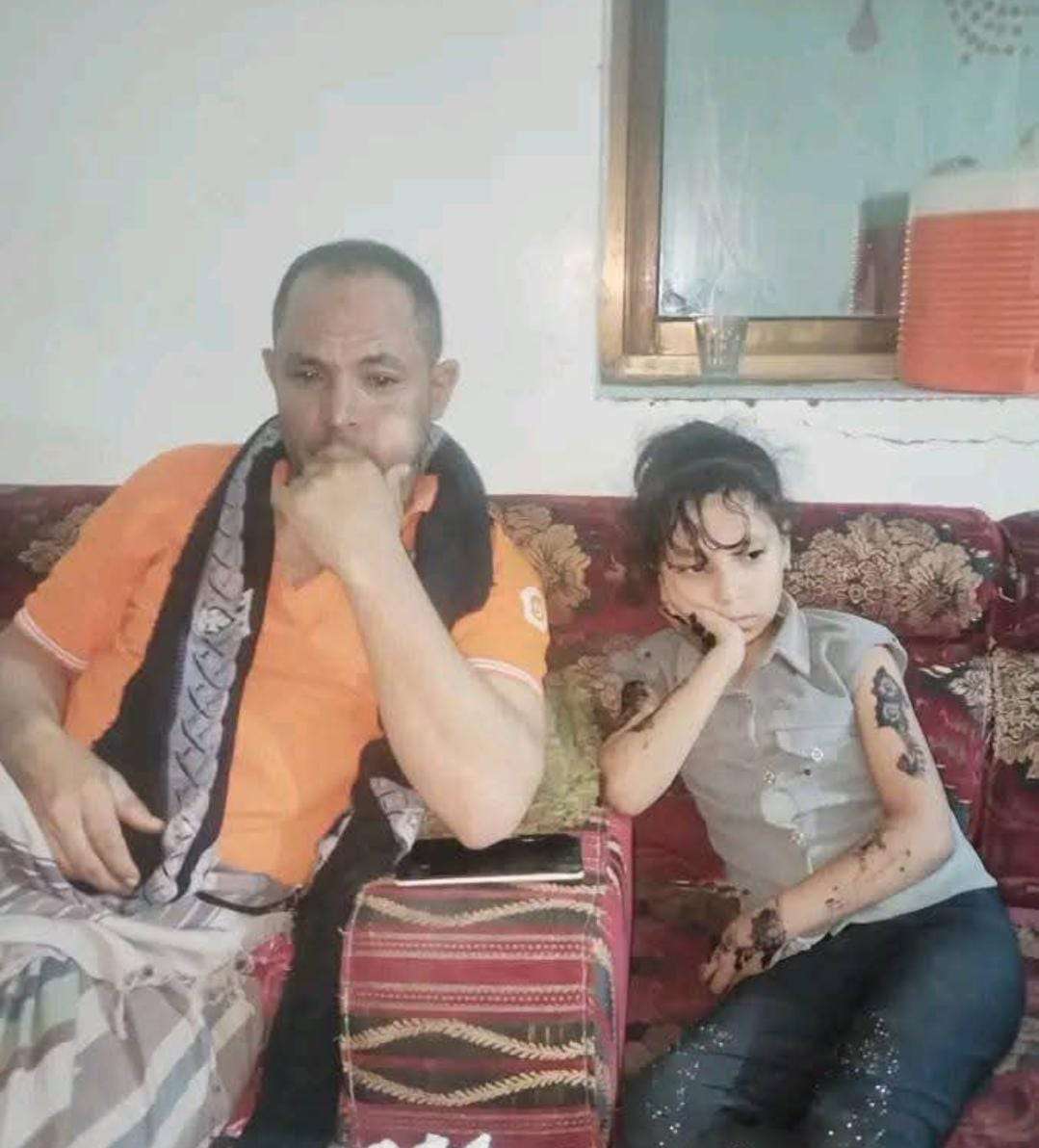قناص حو ثي يحرم أسرة في تعز من فرحة العيد