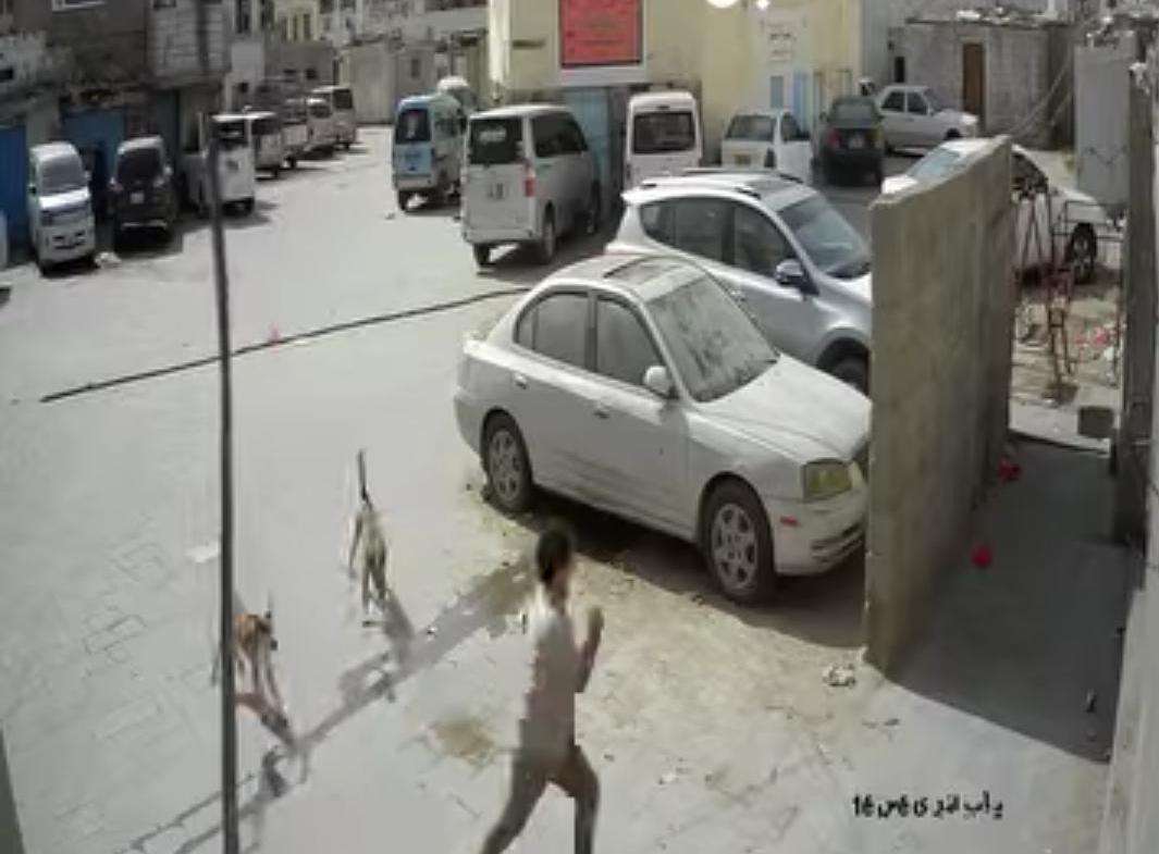 طفل ينجو من هجوم كلاب ضالة بعدن