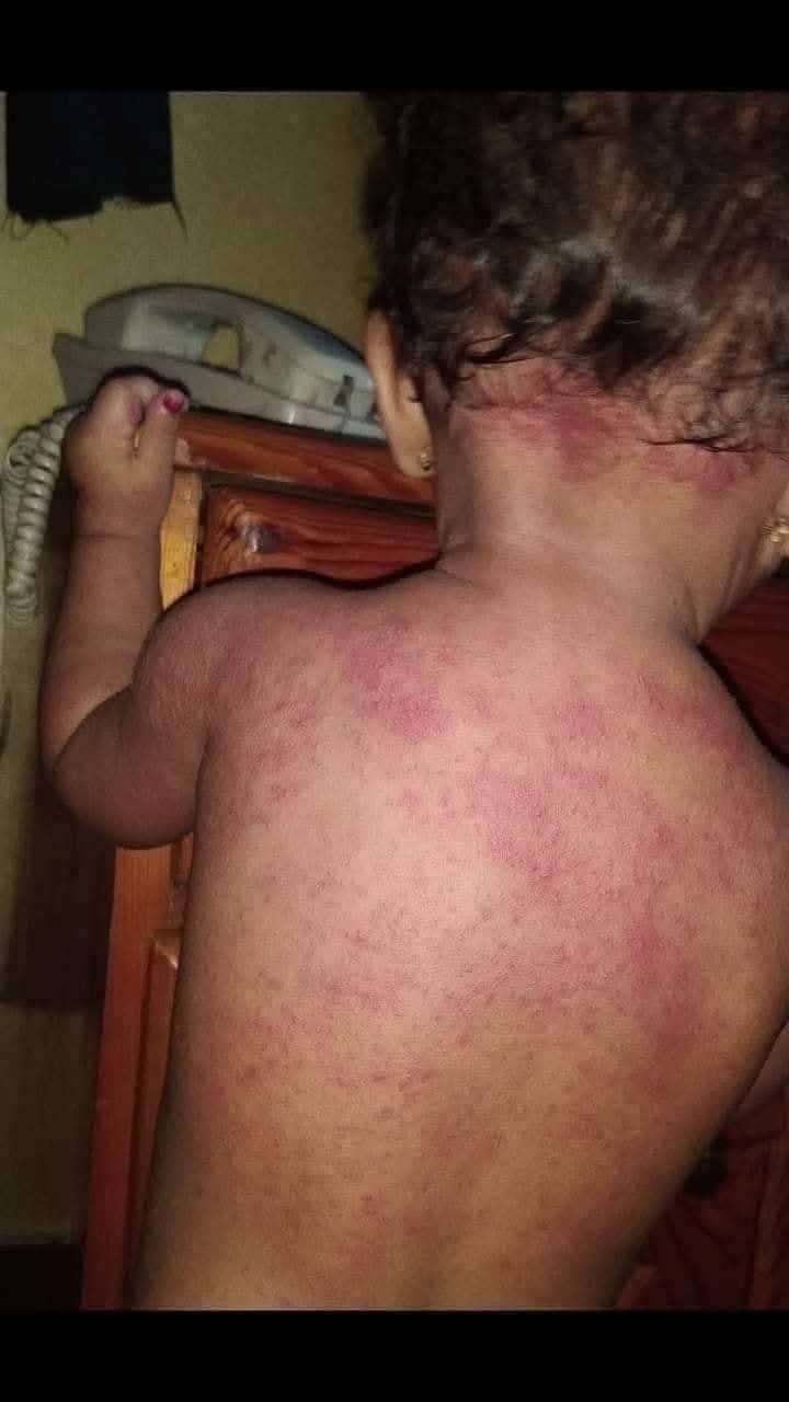 الداعري يحذر من كارثة إنسانية بعدن بسبب انتشار هذا الامر المخيف