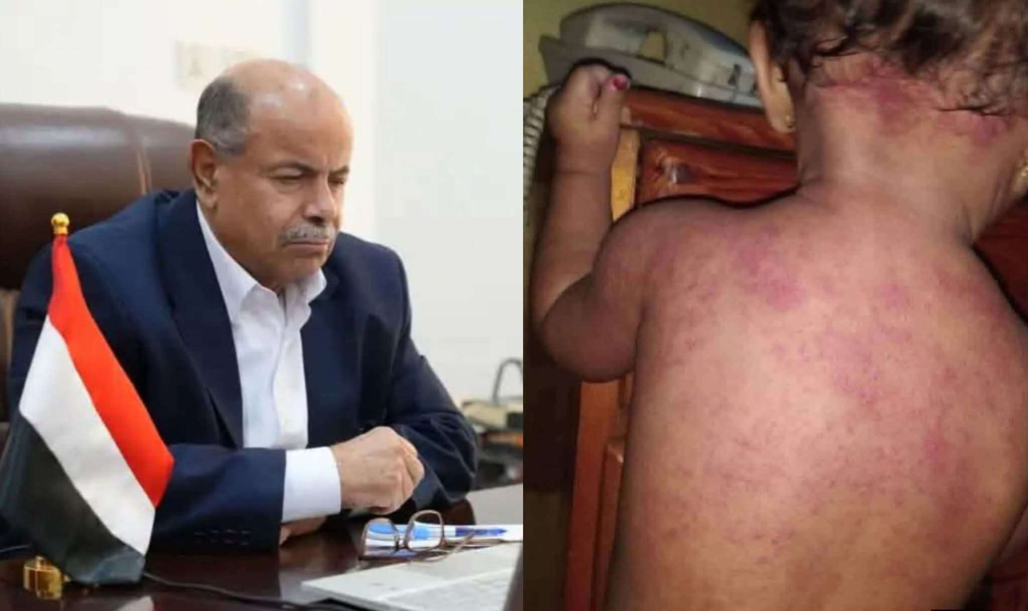 الكشف عن المسؤول البارز الذي خنق عدن بازمة الكهرباء الكشف عن المسؤول البارز الذي خنق عدن بازمة الكهرباء