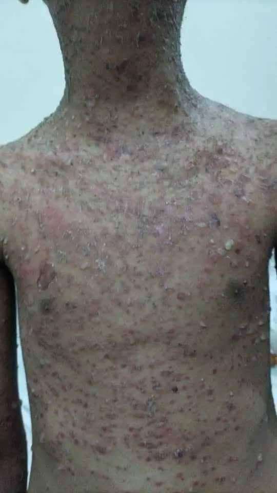 دعوات شعبية للنوم بالشارع بسبب الكهرباء بعدن
