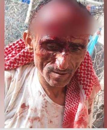 طبيب يتعرض لاعتداء وحشي