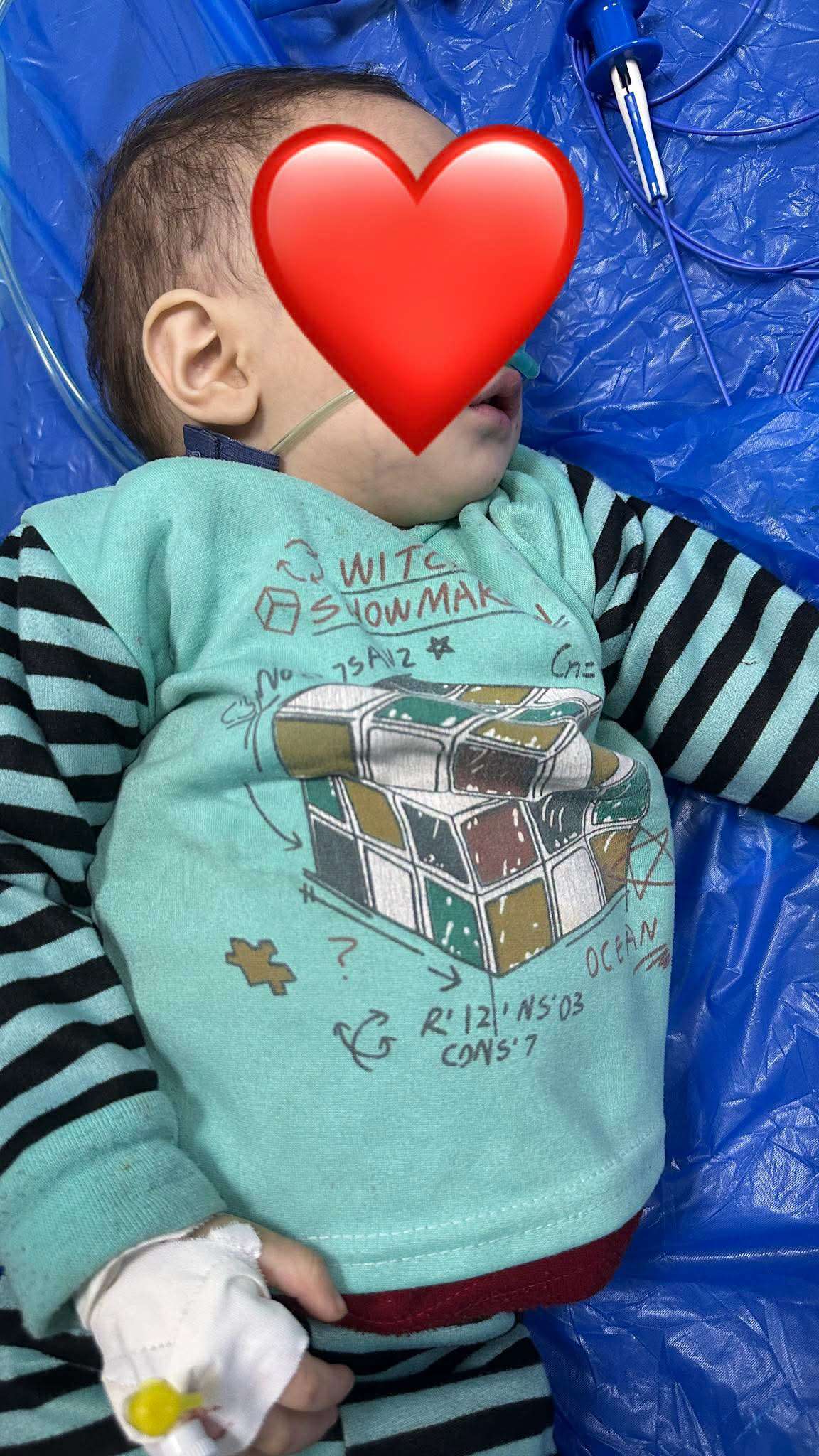 إنقاذ طفلة ابتلعت قطعة معدنية في إب