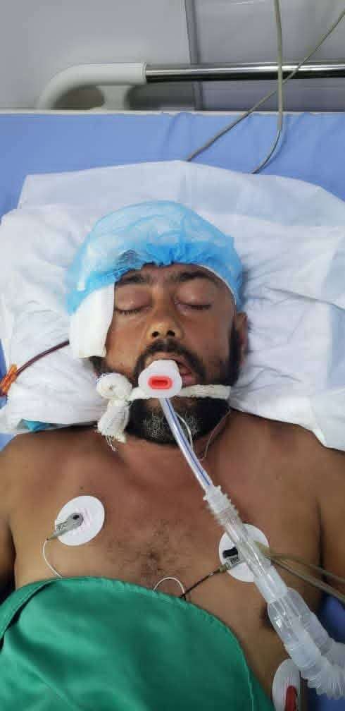 بلاغ أمني: مصاب مجهول الهوية بحادث مروري في ذمار