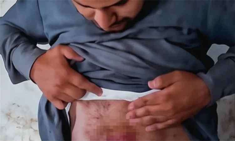 تعذيب مواطن داخل سجن حو ثي بصعدة وسط مطالبات بالكشف عن مصيره