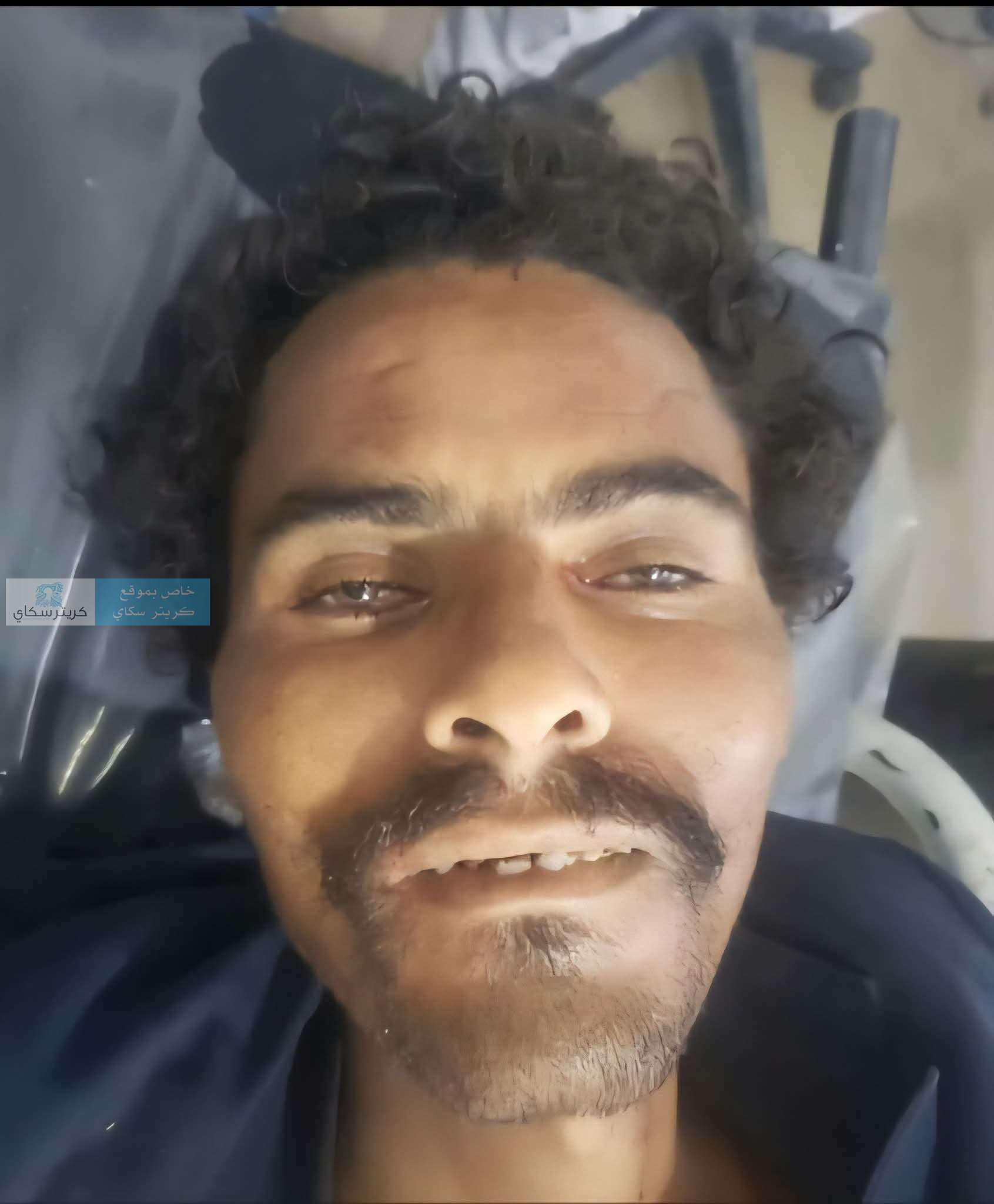 جثة مجهولة الهوية بعد حادث مروري.. نداء عاجل للتعرف على صاحبها