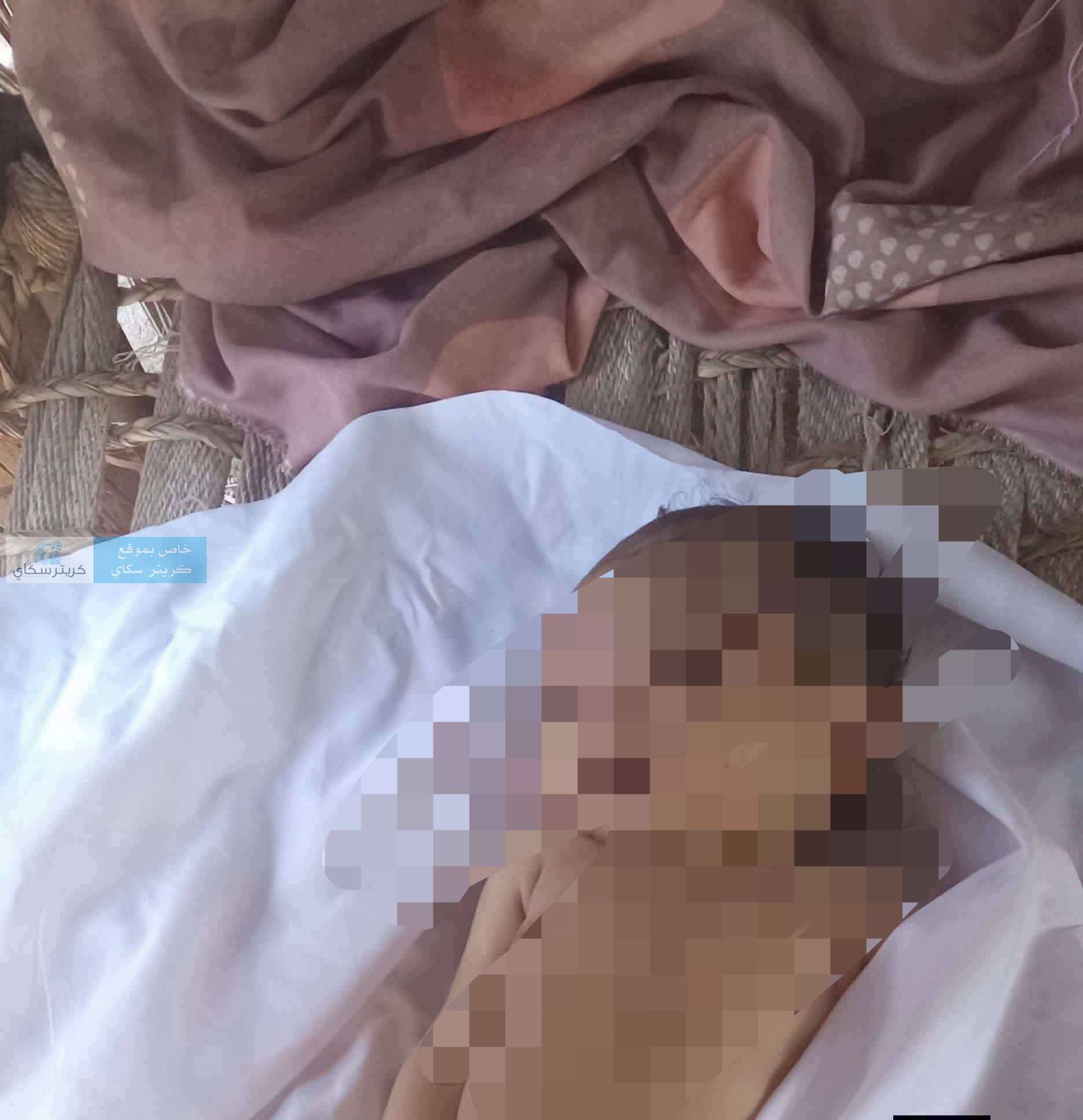 صورة تختصر المأساة.. طفلة من المضاربة ضحية للقصف الحو ثي صورة تختصر المأساة.. طفلة من المضاربة ضحية للقصف الحو ثي