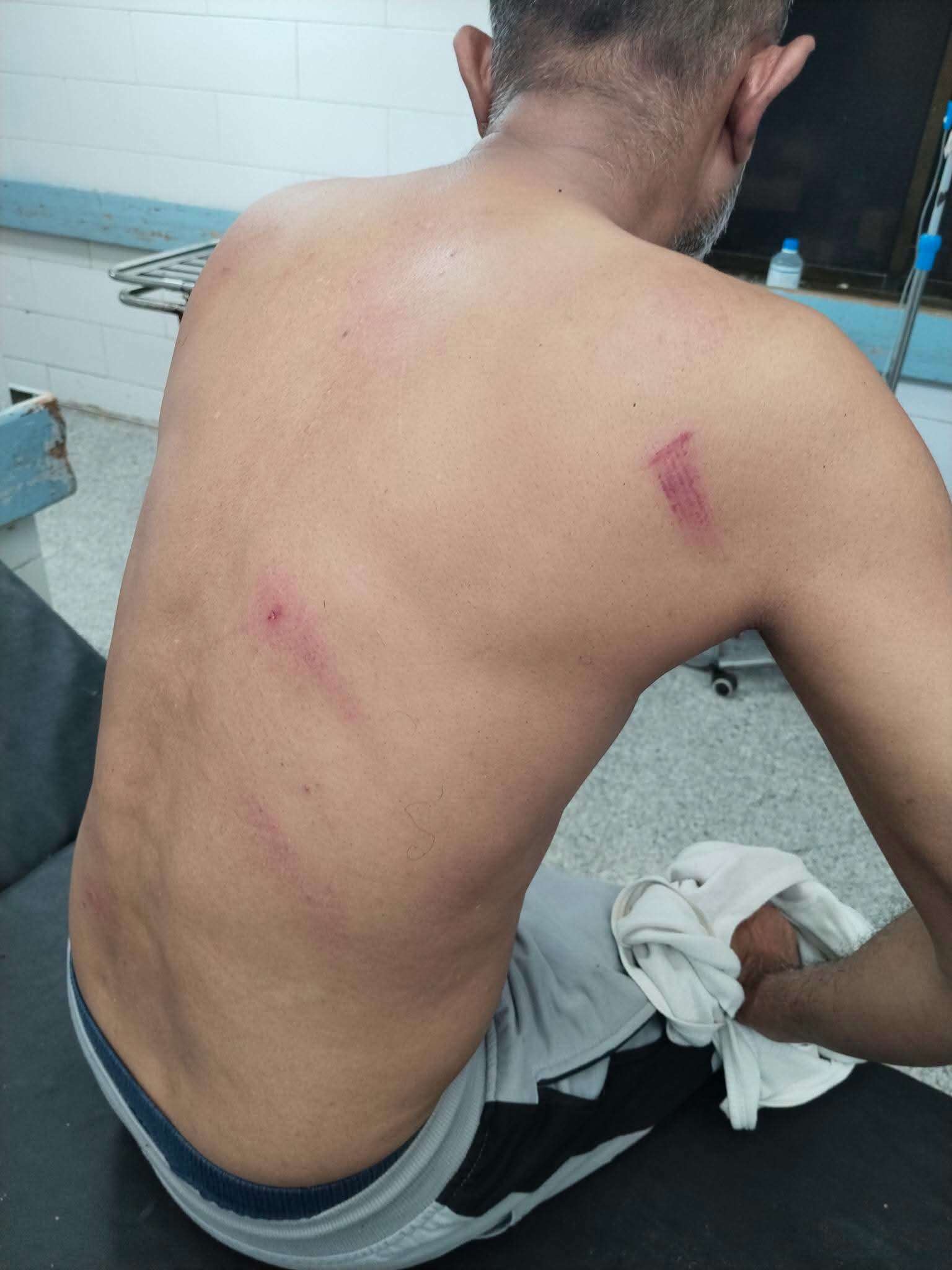 محامٍ بعدن يحمل شرطة خورمكسر مسؤولية سلامته بعد تعرضه للطعن
