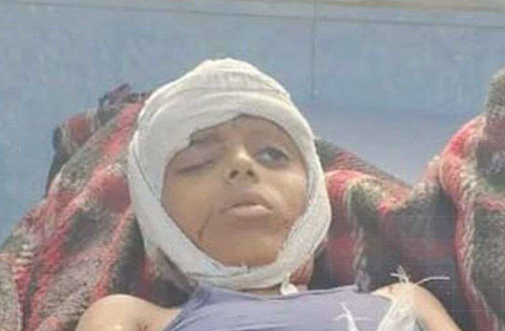 مقتل طفل وإصابة امرأة بقصف استهدف منزلًا شرقي تعز مقتل طفل وإصابة امرأة بقصف استهدف منزلًا شرقي تعز