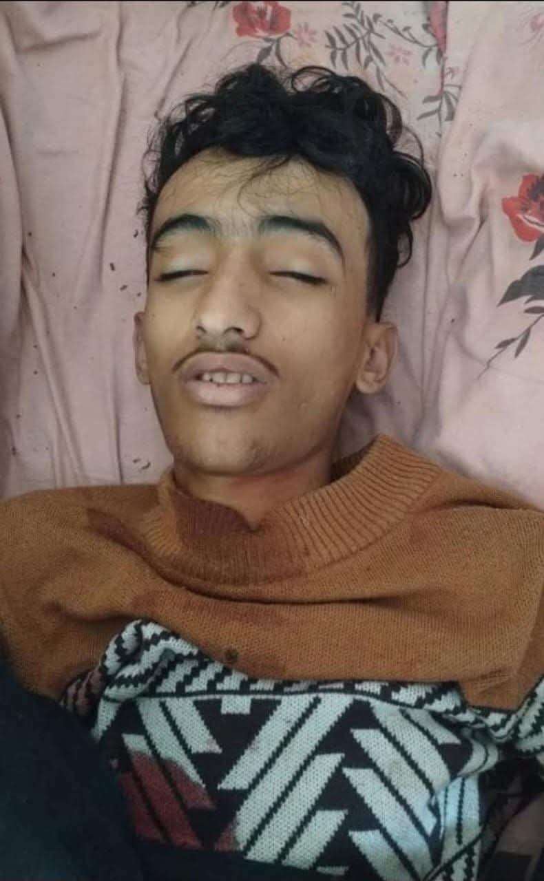 جريمة مروّعة ..&nbsp; الحو ثيين يقتلون الطفل عمار ياسر الشريحي في تعز والسبب صادم !