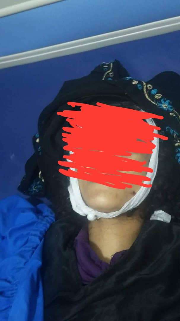 مواطن يقتل زوجته بطريقة بشعة في إب