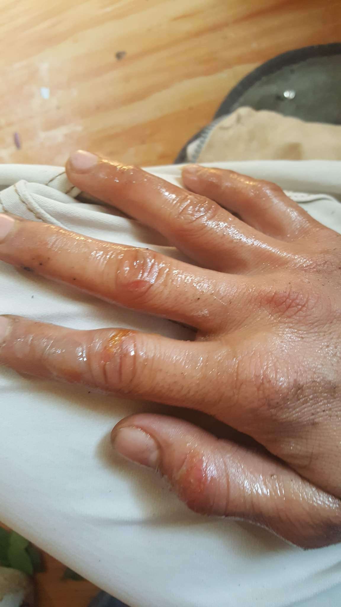 نجاة صحفي واسرته من موت محقق بعدن
