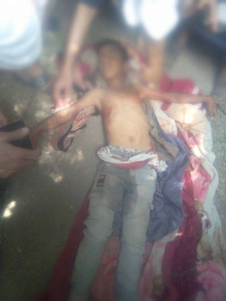 مقتل طفل وإصابة آخر برصاص الأمن غرب تعز(تفاصيل+صورة)