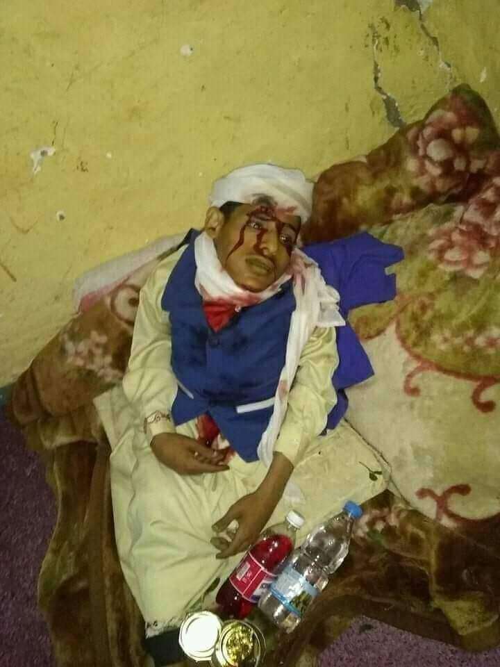 عاجل : بعد عزومة له مقتل حميد (صورة)