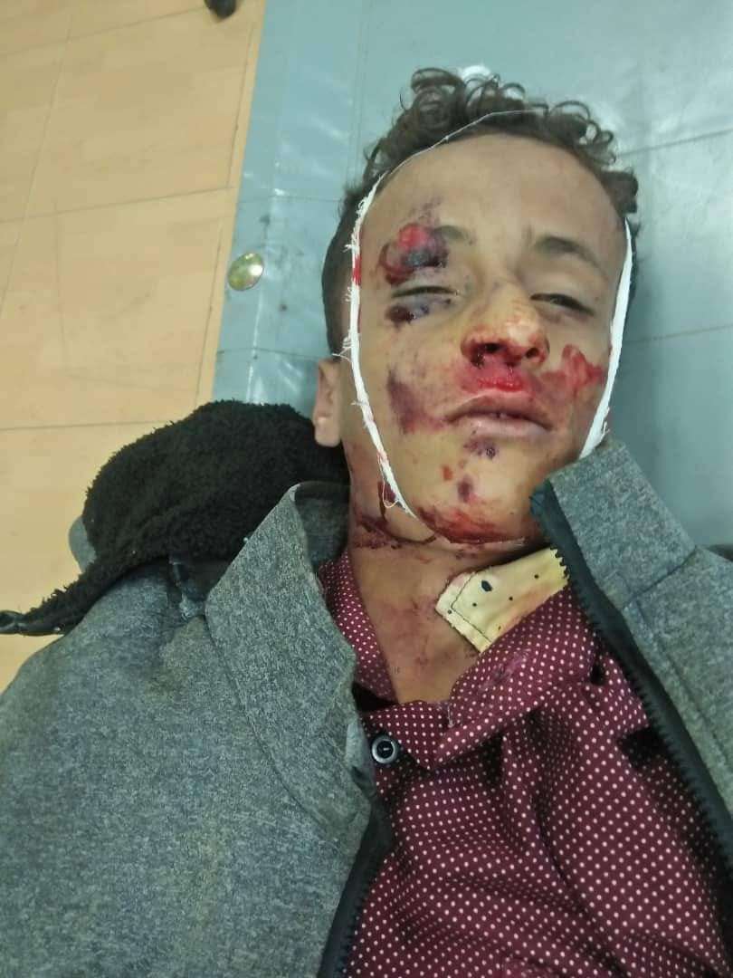 دعوات للتعرف على طفل توفي جراء حادث مروري مروع في لحج