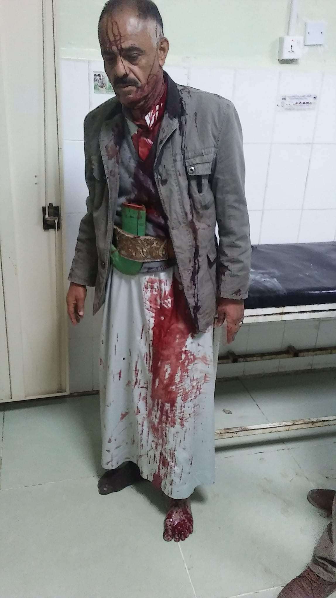 عاجل : بيان هام حول ماحدث في صنعاء