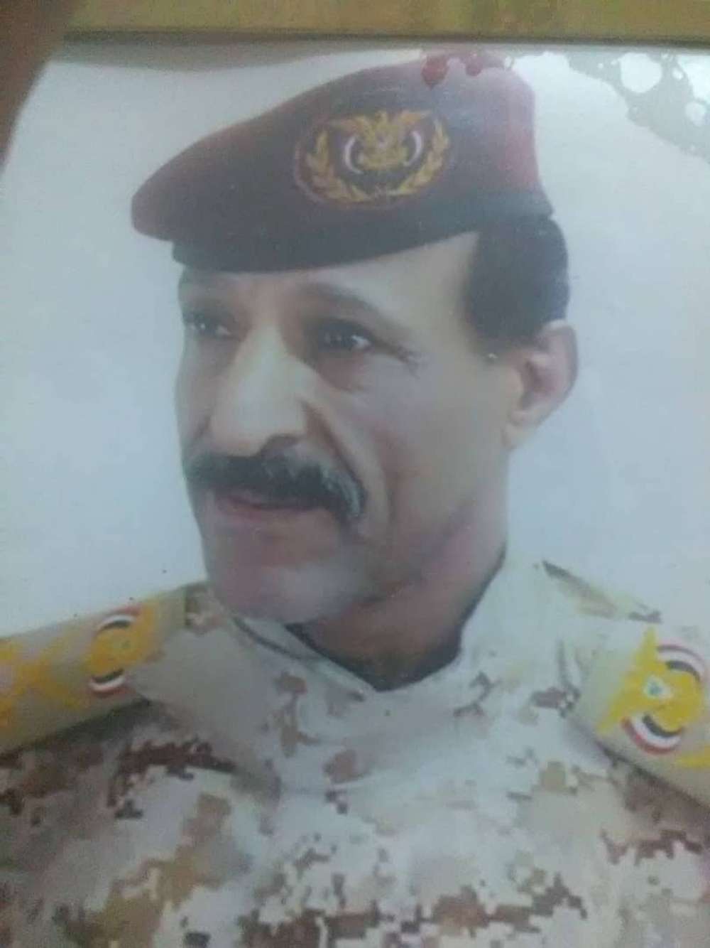 نقل قائد عسكري كبير إلى إحدى مشافي عدن نقل قائد عسكري كبير إلى إحدى مشافي عدن