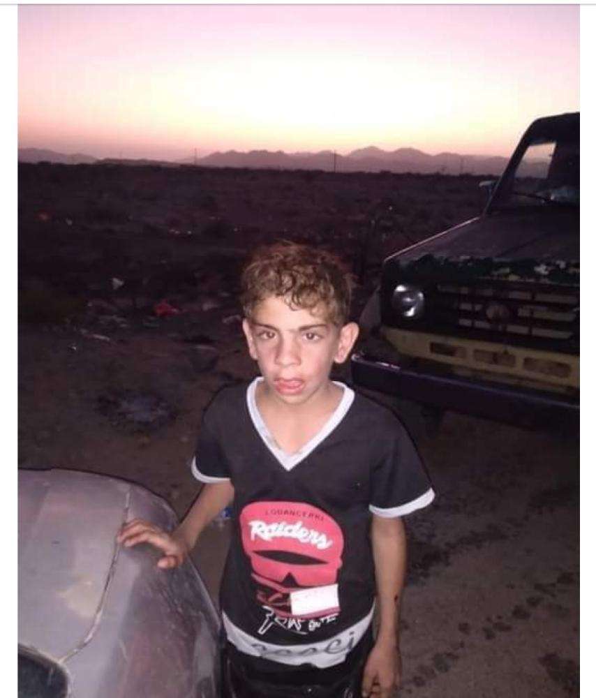 العثور على طفل سوري ضائع في أبين العثور على طفل سوري ضائع في أبين