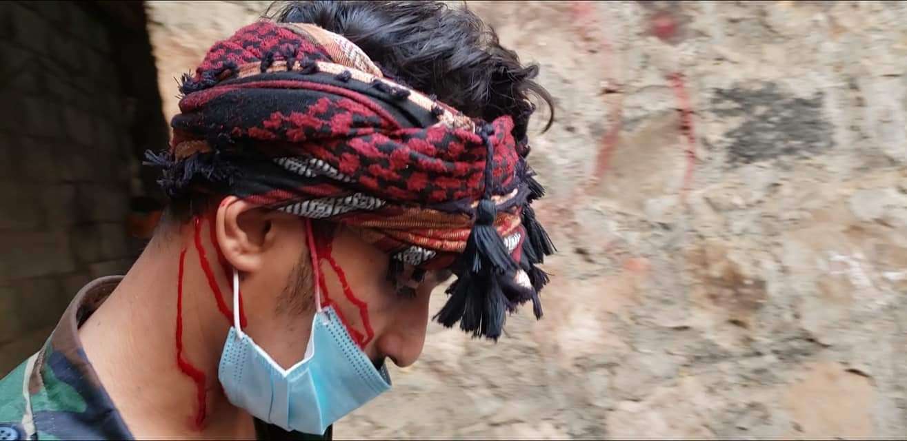 إصابة الصحفي راكان الجبيحي بشظايا قذيفة في مقبنة