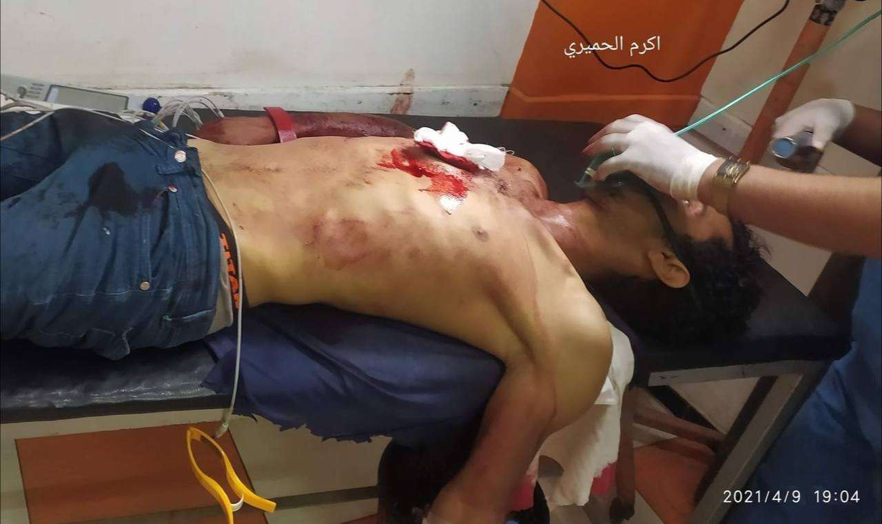إصابة شاب في تعز برصاص قناص حوثي وهو يصلي في منزله