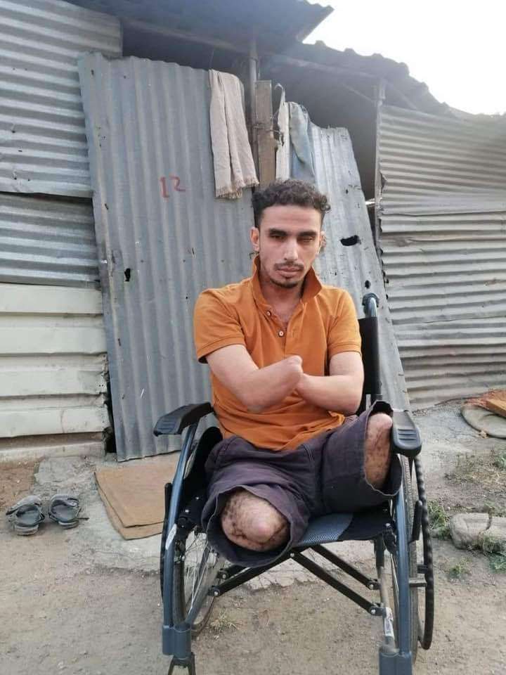 بعد إن تم المناشدة لعلاجه .. نائب بالبرلمان يعلن تكفل نائب الرئيس بعلاجه