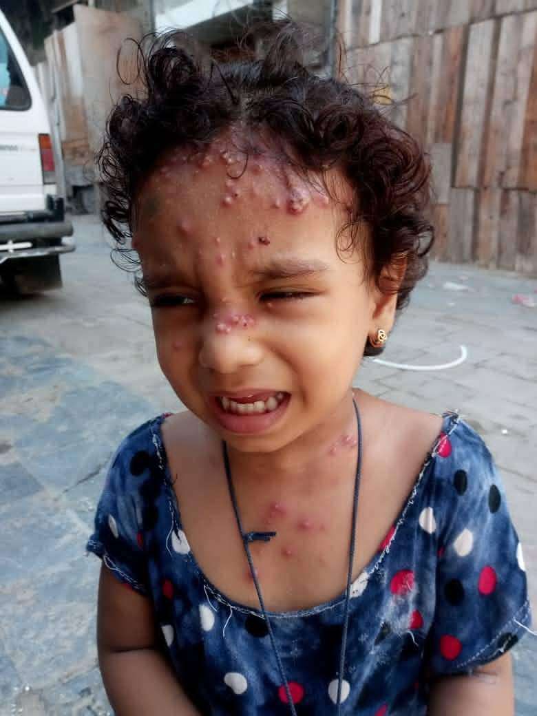 هكذا يدفع اطفال الحديدة ضريبة إنقطاع التيار الكهربائي(صورة)