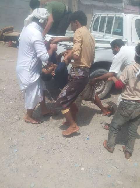 عاجل :سقوط ٦ بين قتيل وجريح باشتباكات عنيفة في المخا(صور)